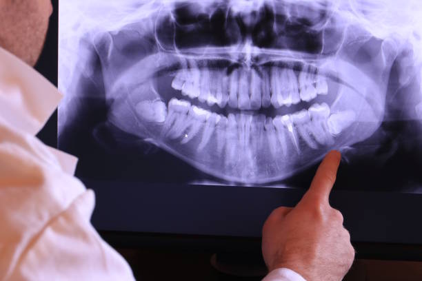 Best Chipped Tooth Repair Near Me  in Nashville, AR