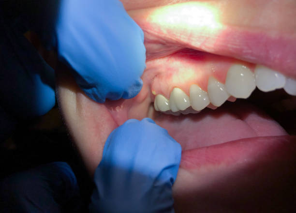 Best Emergency Dentist Near Me  in Nashville, AR