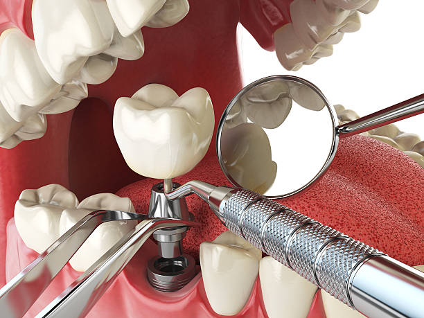 Best Emergency Gum Pain Relief  in Nashville, AR