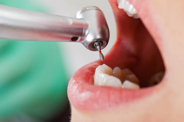 Best Emergency Dentist Open Today  in Nashville, AR